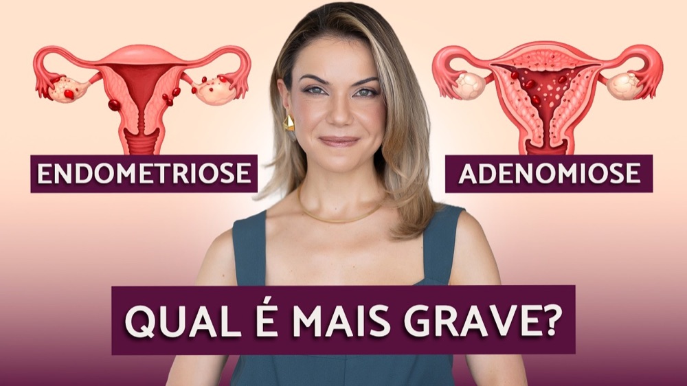 Capa do vídeo sobre adenomiose e endometriose