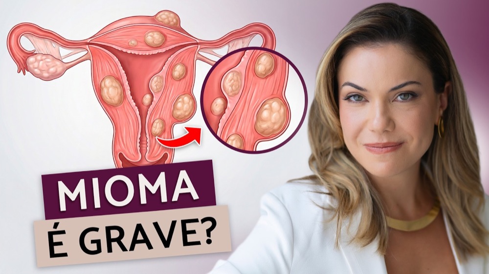 Capa do vídeo sobre mioma no útero